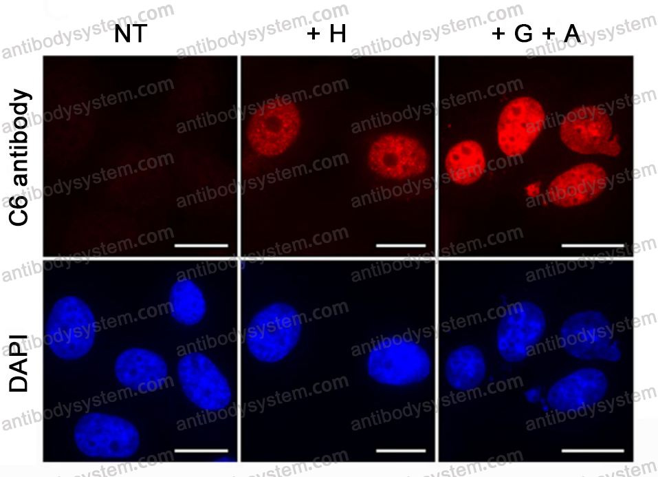 Anti-Phospho-γ-H2AX (pS139) Antibody (C6)